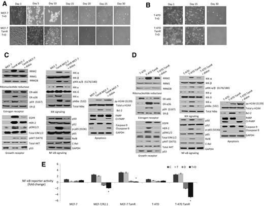 Figure 4. Didox treatment circumvents tamoxifen resistance via inhibiting ER alterations and NF-κB activity. A and B, time-lapse images. C and D, expression protein profiling. E, NF-κB reporter activity in parental as compared with TamR cells upon control (C), tamoxifen (T), didox (D), and T + D treatment. Significant reduction in NF-κB reporter activity was observed in MCF-7/R2.1 cells (P < 0.002), MCF-7TamR cells (P < 0.03), T47D-TamR cells (P < 0.001). *, P < 0.03.
