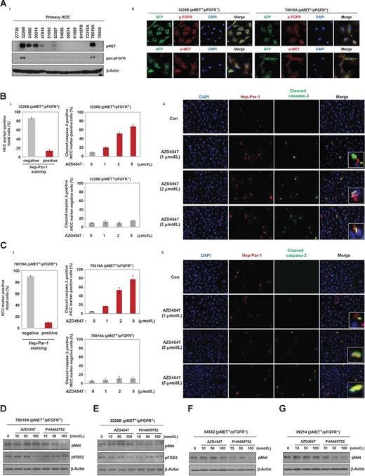 Figure 6. Effects of MET or pan-FGFR inhibitor on primary cancer cells from patients with hepatocarcinoma. A, i, levels of expression of phospho-MET and phospho-FGFR were evaluated by Western blotting of primary HCC cells; β-actin was used as loading control.; A, ii, immunofluorescence analysis of primary HCC cells. 78019A and 3226B cells expressed pMET, pFGFR, and AFP (B and C). Differential effects of the MET inhibitor (PHA665752) or pan-FGFR inhibitor (AZD4547) on 3226B (B) and 78019A (C) cells were determined by immunofluorescence analysis. The 3226B and 78019A cells expressed Hep-par-1 and cleaved caspase-3 after AZD4547 treatment at the indicated concentrations as shown by immunofluorescence (D and E). Primary HCC cells 78019A and 3226B were treated with various concentrations of PHA665752 or AZD4547. These cells expressed both phospho-FGFR and phospho-MET. Cells were harvested and analyzed by Western blotting using antibodies directed against phospho-MET and phospho-FRS2; β-actin was used as loading control. 34582 (F) and 39214 (G) cells expressed only phospho-MET and not phospho-FRS2. The cells were treated with PHA665752 or AZD4547 at the indicated concentrations. Cells were harvested and analyzed by Western blotting using antibodies directed against phospho-MET and cleaved caspase-3; β-actin was used as loading control.