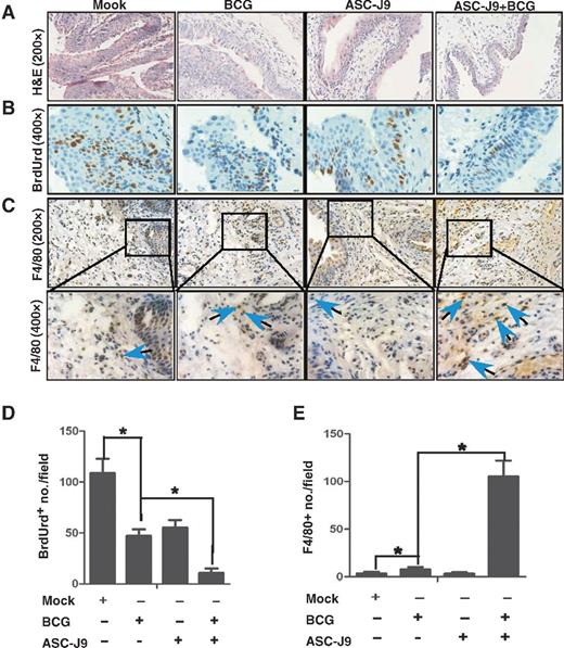 Figure 5. ASC-J9 potentiates the antitumor effects of BCG in BBN-induced mouse bladder cancer model. Twelve-week-old FVB female mice were divided into 4 groups (10 mice/group) and treated with 0.05% BBN in drinking water for 12 weeks. Mice were then injected with (i) vehicle control, (ii) BCG (2 × 106 CFU/mouse, intravesical injection weekly) alone, (iii) ASC-J9 (75 mg/kg body weight, every other day, IP) alone, or (iv) BCG (2 × 106 CFU/mouse, intravesical injection weekly)+ASC-J9 (75 mg/kg body weight, every other day, IP). Mice were then sacrificed 48 hours after the fourth injection and bladders collected for further examination, including H&E section (A) and BrdUrd stain (B) for the bladder cancer cell proliferation. C, we used monocytes/macrophages marker F4/80 antibody to assay monocyte/macrophage cells infiltration. D and E, the positive expression of BrdUrd and F4/80 were quantified in three random fields. Blue arrows, positive cells; *, P < 0.05 (Student t test).
