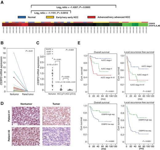 Figure 1. Evaluation of the clinical significance of CEBPD expression in hepatocellular carcinoma. A, data mining of transcriptome data (GSE6764) from the public domain demonstrated that CEBPD expression is significantly downregulated in HCC and its attenuation is more significant in very advanced tumors. Confirmation of the downregulation of CEBPD in 27 pairs of HCC specimens in a stepwise manner (B) correlates with tumor stage (C). D, representative IHC assay in two paired HCC specimens showing CEBPD staining. E, both the overall survival and local recurrence-free survival of HCC patients were determined using the Kaplan–Meier method.