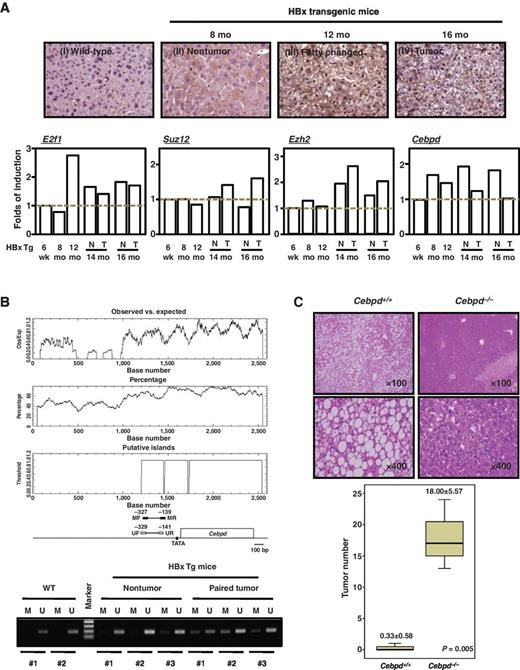 Figure 2. CEBPD is activated in inflamed liver and its inactivation is associated with the occurrence of HCC. A, loss of CEBPD was associated with HCC formation in HBx Tg mice. An IHC assay was performed using CEBPD antibody (top). Quantitative data of E2f1, Suz12, Ezh2, and Cebpd transcripts were extracted from the transcript microarray of the livers of HBx Tg and age-matched wild-type mice with SD (bottom). B, sequence locations between −1,600 and +1,000 bp of the Cebpd gene were predicated by the EBI website CpGPlot program. The correlated positions are represented in the scheme. The CpG methylation status of CEBPD promoters in 18-month-old wild-type (WT) or HBx Tg mice was performed using MSP analysis. A visible PCR product in lanes M and lanes U indicates the presence of methylated alleles and unmethylated alleles, respectively. C, wild-type (Cebpd+/+) and Cebpd-deficient B6 mice were kept on normal chow until 6 weeks of age and then were maintained on HFD until 16 months of age. At the 16th week of age, the mice were given DEN until 16 months of age. Mice were sacrificed and analyzed by IHC staining. The IHC images were then quantified in the bottom panel.