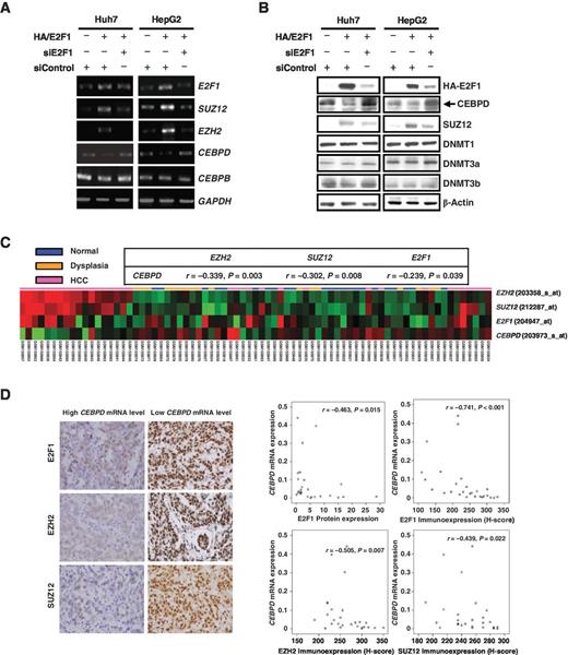 Figure 3. E2F1 represses CEBPD transcription in liver cancer cells. A and B, RT-PCR and Western blot analyses were performed with total RNA and cell lysates harvested from Huh7 or HepG2 cells transfected with the indicated expression vectors, respectively. C, transcriptome data (GSE6764), CEBPD mRNA was negatively correlated with E2F1, EZH2, and SUZ12 transcripts. Moreover, the CEBPD-low and E2F1 axis-high cluster (cluster 1) is significantly associated with advanced and very advanced disease. D, evaluating E2F1, EZH2, and SUZ12 expression in relationship to CEBPD mRNA levels in 27 snap-frozen HCC samples. Right four panels show the quantified results.