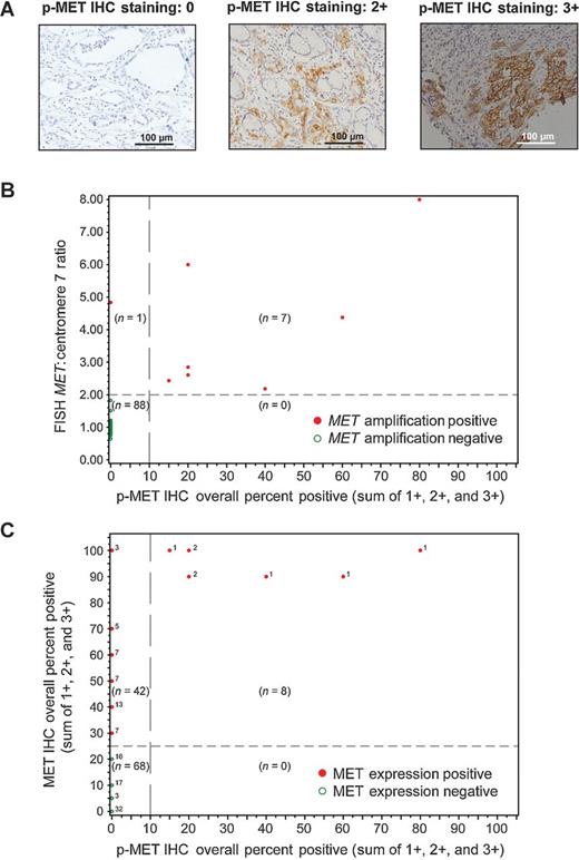 Figure 4. Phospho-MET results. A, representative p-MET immunohistochemistry staining images. B, scatter plot indicating p-MET IHC overall percent positive versus FISH MET:centromere 7 ratio (n = 96). There was a significant association between p-MET expression and MET amplification (P < 0.001). C, scatter plot indicating p-MET IHC overall percent positive versus MET IHC overall percent positive (n = 118). There was a significant association between p-MET expression and MET expression (P < 0.001). Numbers indicate the number of patients represented at each data point.