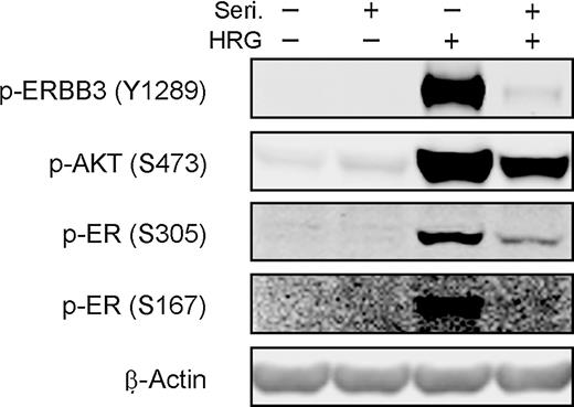 Figure 1. HRG activates ER phosphorylation in MCF-7Ca cells. Serum-starved MCF-7Ca cells were pretreated with seribantumab (Seri; 1 μmol/L) for 1 hour, followed by treatment with 10 nmol/L HRG for 10 minutes, where indicated (+). Cell lysates were analyzed by immunoblotting with antibodies for p-ERBB3 (Y1289), p-AKT (S473), and p-ER (S305 and S167). Anti-β-actin antibody was used as a loading control.