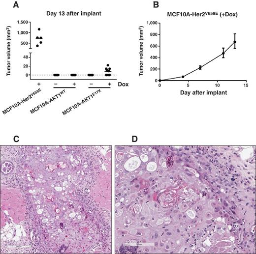 Figure 2. AKT1E17K overexpression promotes tumor formation in vivo. The indicated MCF10A cells were implanted in the mammary fat of mice ± doxycycline chow. A, thirteen days after implanting cells, only mice supplemented with doxycycline chow with MCF10A-HER2V659E or MCF10A-AKT1E17K implanted grew measurable tumors. B, growth kinetics of the MCF10A-HER2V659E tumors. C and D, representative low and high magnification images of an MCF10A-AKT1E17K tumor 35 days after implantation. Magnification is 3× and 20×, respectively.