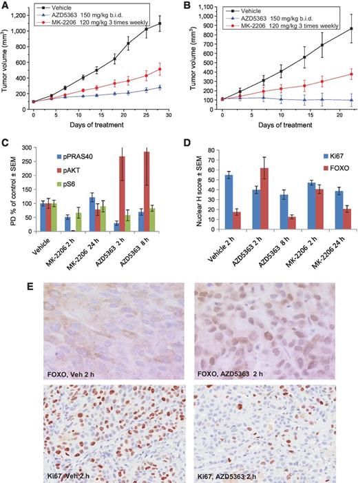 Figure 4. AKT inhibitors inhibit tumor growth and demonstrate pharmacodynamic activity in breast cancer explant models with AKT1E17K mutations. A and B, triple negative, AKT1E17K-mutant breast cancer explant models HBc-x2 (A) and HBc-x31 (B) (Xentech) were chronically dosed with vehicle, AZD5363, or MK-2206 and tumor growth was monitored using calipers; b.i.d., twice daily. C, pathway biomarkers were measured in lysates from HBC-x2 tumors at the end of the antitumor study, by Western blotting or ELISA. D and E, nuclear FOXO3a and Ki67 in sections from HBC-x2 tumors at the end of the antitumor study were measured by immunohistochemistry.