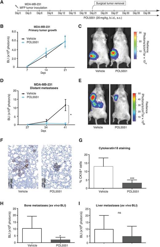 Figure 3. CXCR4 antagonist POL5551 decreases metastasis, but has little effect on primary MFP tumor growth in a xenograft NSG model. A, MDA-MB-231 mammary fat pad orthotopic model schema: MDA-MB-231 tumor cells were injected to the mammary fat pad of mice. Treatment with POL5551 (20 mg/kg, s.c., twice daily, n = 3) or saline (n = 5) commenced on day 8 when the tumor became palpable and continued until the end of study. B and C, primary MFP tumor growth as measured by bioluminescence imaging, representative image showing the primary tumors on day 21. D and E, distant metastasis to the chest as measured by bioluminescence imaging, representative image showing the distant metastases on day 41 (*, P < 0.05). F, human CK-18 staining of MDA-MB-231 tumor cells in lung tissue. G, quantification of CK18-positive cells in lung tissue; ***, P < 0.001; H, ex vivo BLI of bone metastases (*, P < 0.05). I, ex vivo BLI of liver metastases (ns, P > 0.05).
