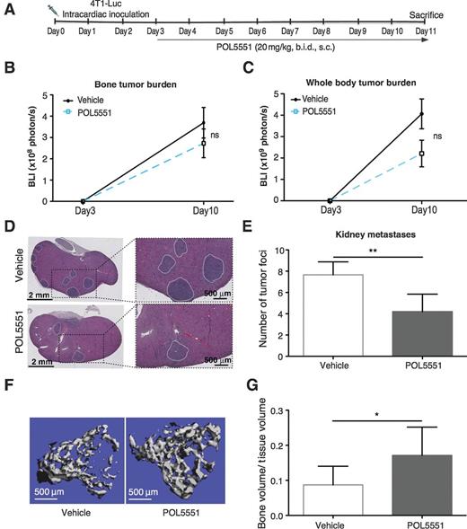 Figure 4. POL5551 monotherapy decreased distant metastasis in a disseminated tumor model. A, an intracardiac tumor injection model, 4T1-Luc murine tumor cells were injected into the left ventricle of the BALB/c mice. Treatment with POL5551 (20 mg/kg, s.c., twice daily, n = 7) or vehicle (saline, n = 6) was from days 3 to 11. Mice were sacrificed on day 11. B and C, BLI of 4T1-Luc tumor burden in leg bones (ns, P = 0.23) and whole body (ns, P = 0.08). D, H&E staining of kidney tissue, 4T1 tumor foci/nodules are outlined in white to increase visibility. E, quantification of 4T1 tumor foci in kidney per section (n = 6/group; **, P < 0.01). F and G, μCT analysis for calculation of trabecular bone to tissue volume ratio (BV/TV; n = 6/group; *, P < 0.05).