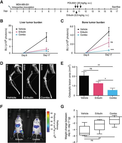 Figure 6. Reduction of bone tumor burden: POL5551 in combination with eribulin is superior to eribulin alone. A, schema of bone metastasis model utilizing “framing dose” strategy: MDA-MB-231 bone metastases were established by intracardiac inoculation in NSG mice, and on day 10 mice were treated as following: A, vehicle (n = 4): saline (s.c. and i.v.); B, eribulin alone (n = 5): eribulin (0.2 mg/kg, i.v.) alone and saline (s.c); C, combination treatment (n = 5): POL5551 (20 mg/kg, s.c.) was administered 4 hours before eribulin and 4 and 18 hours after eribulin (0.2 mg/kg, i.v.) chemotherapy. B and C, BLI of tumor burden in liver and bone (*, P < 0.05; ***, P < 0.001). D, representative X-Ray images of tumor-associated osteolytic lesion in leg bone. E, quantification of osteolytic lesion area. F, representative image showing extent of metastatic burden in liver and leg bone on day 17 (*, P < 0.05; **, P < 0.01). G, mouse weight lost between days 9 and 17. Statistical analyses are as compared with vehicle treatment (ns, P > 0.05; **, P < 0.01).