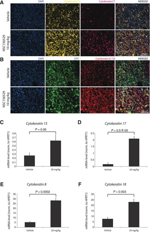 Figure 6. NSC156529 induces tumor cell differentiation in PC-3 tumor xenografts. The PC-3 xenograft cryosections were immunostained with antibodies recognizing CK15, CK17 (A) and CK8, CK18 (B). The expression of cytokeratins 15 and 17 (CK15/17; C and D) and cytokeratins 8 and 18 (CK8/18; E and F) was measured by qPCR and normalized to Hprt1. The mean of three experiments is shown.