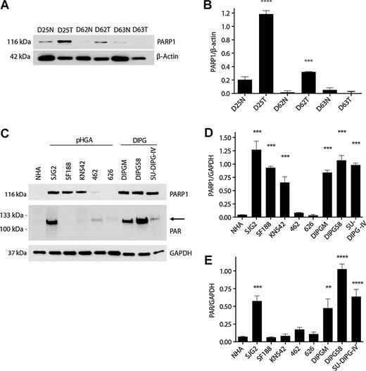 Figure 1. PARP1 protein is expressed in pHGA and DIPG patient samples and cell lines. A and B, protein expression and densitometry of PARP1 in normal tumor pairs obtained from three DIPG autopsy samples (D25N, D62N, D63N matching normal tissue; D25T, D62T, D63T tumor tissue). C–E, Western blotting and densitometry of PARP1 protein levels and PARP1 activity demonstrating variable expression in NHA, pHGA (SJG2, SF188, KNS42, 462, 626), and DIPG (DIPGM, DIPG58, SU-DIPG-IV) cell lines. **, P < 0.01; ***, P < 0.001; ****, P < 0.0001. Error bars, SEM.