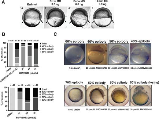 Figure 3. Phenotypic screening of selected hits from the MMV400 library for reduced cell motility phenotypes in zebrafish embryonic developmental assays. A, ezrin morphant embryos are shown at the time that wild-type siblings have reached the 60% epiboly stage (a). Arrows mark the location of marginal regions in wild-type embryos at 60% epiboly. Embryos were injected at the single-cell stage with 3.3 ng ezrin MO (b), 6.6 ng ezrin MO (c), or 9.9 ng ezrin MO (d). Ezrin MO injections result in retarded epiboly, a thickened blastoderm, and defective involution of the blastoderm. B, small molecule–treated embryos were scored for epiboly defects at early stages of development between 7.0 and 8.5 hpf. Embryos treated with small molecule inhibitor of ezrin, NSC305787, completely mimicked ezrin-MO-injected embryos. Treatment of the embryos with the MMV Malaria Box compounds MMV020549 and MMV667492 resulted in delay of the epiboly progression around the yolk with increasing concentration of drugs compared with vehicle-treated group. C, representative images of embryos treated with NSC305787 and MMV Malaria Box compounds MMV020549 and MMV667492 from B are presented with different degrees of epiboly defects, compared with vehicle-treated controls, observed between 7.0 and 8.5 hpf.