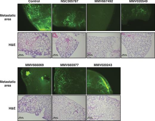 Figure 5. Representative images for lung metastatic growth of GFP-expressing K7M2 cells and the corresponding H&E staining of lung sections treated with either vehicle or anti-ezrin compounds in PuMA are presented on the top and bottom panels, respectively.