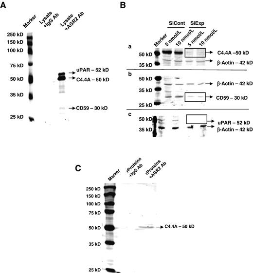 Figure 2. C4.4A and other LY6 family receptors interact with AGR2. A, several candidate receptors (uPAR, C4.4A, and CD59) coimmunoprecipitated with AGR2, whereas DAG-1 did not. B, silencing of C4.4A, CD59, and uPAR was accomplished using siRNAs at two different concentrations. Significant silencing was shown by Western blotting with respective antibodies, and the same membranes were blotted for β-actin, which served as loading control. Both concentrations of siRNA showed significant silencing. Micrographs shown are representation of three independent experiments. C, purified recombinant AGR2 and C4.4A were also coimmunoprecipitated from their suspension, supporting a direct interaction of AGR2 and C4.4A.