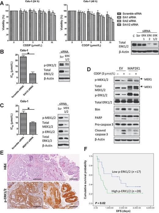 Figure 3. High p-ERK1/2 modulates cisplatin sensitivity in lung SCC cells, and correlates to poor DFS in patients with HNSCC following cisplatin treatment. A, cell viability of Calu-1 cells upon cisplatin (CDDP) treatment (24 and 48 hours) after ERK1/2 knockdown was assessed with CellTiter assay. Values represent the change in viable cell (%) relative to the control group ± SD (n = 4). Immunoblots validate ERK1/2 siRNA knockdown in Calu-1 cells. Cisplatin IC50 ± SD (n = 3) of Calu-1 cells after silencing of ERK1/2 (B) and MEK1/2 (C) was determined with CellTiter assay after 72 hours of cisplatin treatment. Immunoblots validate ERK/MEK siRNA knockdown in Calu-1 cells. D, immunoblots show the effects of MAP2K1 (D67N) overexpression on affecting cisplatin-induced apoptosis in H596 cells. 50 nmol/L siRNA or 1 μg of plasmid was used per transfection. E, immunohistochemical analysis for intracellular expression of p-ERK1/2 in HNSCC tumors (IRS: 2 and 3, left to right) and the corresponding H&E staining. Scale bar, 200 μm. Tumor samples were categorized into high p-ERK1/2 (IRS < 50; n = 17) and low p-ERK1/2 (IRS > 50; n = 28). F, Kaplan Meier curves for DFS are plotted for the high and low p-ERK1/2 populations. Tick marks indicate patients for whom data was censored (Data cutoff point: June 2014). *, P < 0.05.