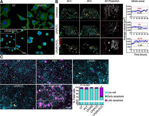 Figure 5. Liposomal tariquidar/paclitaxel–mediated apoptosis following mitotic arrest due to paclitaxel-induced tubulin polymerization. A, confocal microscopy. Immunofluorescent detection of β-tubulin. Images show paclitaxel-induced β-tubulin dysfunction in paclitaxel-resistant SKOV3-TR cells treated with liposomal tariquidar/paclitaxel [LP(XR,PCT)]. Blue, Hoechst; green, β-tubulin. Scale bar, 25 μm. B, holographic imaging cytometry. SKOV3-TR cells were treated with either LP(PCT) or LP(XR,PCT) and visualized by HoloMonitor M4 every 5 minutes for 48 hours. 3D representation of holographic images of cells at 24- or 48-hour treatment is shown. Pseudocoloring of cells allows gauging of cell thickness. Green depicts cells with low optical thickness, such as flat interphase cells, whereas red indicates cells with high thickness such as rounded cells in mitosis. Middle, 4D projection. “Longer streaks” as seen in the LP(XR,PCT) group show mitotic arrest, as these cells are unable to divide and progressively increase in volume and thickness over a long period of time until cell death. Scale bar, 25 μm. Right, quantification of mitotic arrest with data shown in the left (2,500 μm3, a threshold for average volume). C, laser scanning cytometry to detect apoptosis. SKOV3-TR cells were treated (150 nmol/L, PCT) for 24 hours and recovered for 24 hours. The cells were stained with Hoechst (cyan, nuclei), Yo-Pro (green, early apoptosis), and PI (magenta, late apoptosis). Insert, apoptotic bodies are indicated by yellow arrows. Scale bar, 50 μm. In LP(XR,PCT), there are fewer cells because of the combination of reduced cell proliferation and induced apoptosis. Two-way ANOVA.