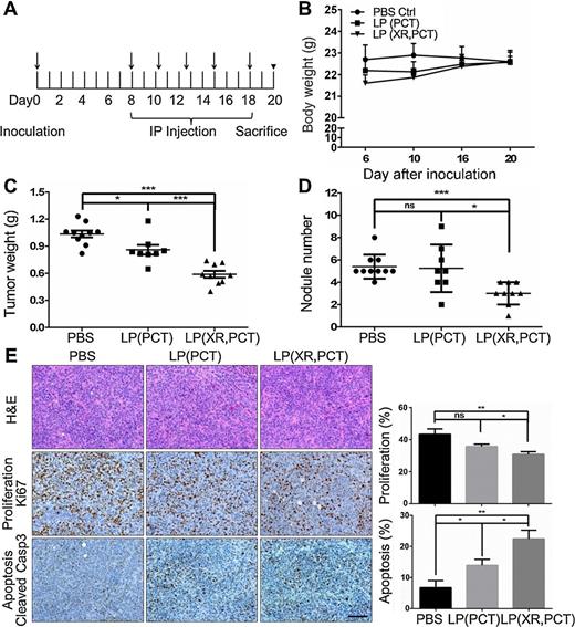 Figure 6. Paclitaxel and tariquidar-loaded liposomes reduced tumor burden in a chemoresistant ovarian cancer xenograft mouse model. A, timeline. One million paclitaxel-resistant HeyA8-MDR cells were intraperitoneally (IP) inoculated into female athymic nude mice (arrow). Eight days later, 15 mice were randomized into 3 groups (n = 5 mice) and treated IP with either liposomal paclitaxel [LP(PCT)] (), liposomal tariquidar/paclitaxel [LP(XR,PCT)] () (1.5 mg/kg, PCT; ∼1 mg/kg, XR) or PBS (). B, body weight. C, tumor weight. D, metastasis. Columns represent means ± SEM from two independent experiments (n > 8 mice). Two and one mouse failed to form tumor in LP(PCT) and LP(XR,PCT) groups, respectively, and therefore were excluded from the assessment. E, H&E staining and immunohistochemistry for cleaved caspase-3 (apoptosis) and Ki-67 (proliferation). Scale bar, 100 μm. The percentage of Ki-67–positive cells and cleaved caspase-3–positive cells over total cells was quantified by ImageJ (right). Bars, means ± SEM (n = 5 mice). ***, P < 0.001; **, P < 0.01; *, P < 0.05. ns, not significant, two-tailed t test.