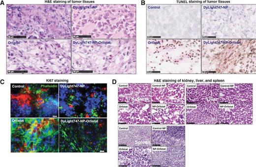 Figure 6. Ex vivo histologic analyses of different organs and tumor tissues extracted from animals bearing tumor xenografts of MDA-MB231 cells treated with different regimens (solvent control, orlistat, DyLight747-NP-Orlistat, and Fol-DyLight747-NP-Orlistat). A, hematoxylin and eosin staining of tumor tissues. B, TUNEL staining of tumor tissues. C, Ki67 staining of tumor tissues. D, hematoxylin and eosin staining of kidney, liver, and spleen tissues collected from the representative animals of four different treatment groups.