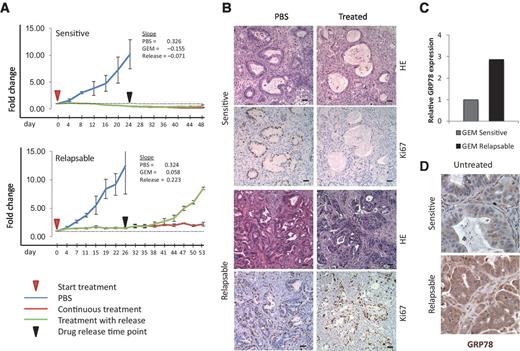 Figure 2. GRP78 expression correlates with chemoresistance in patient-derived xenograft (PDX) model. A, tumor growth over time of mice implanted subcutaneously with PDX samples that were sensitive to GEM treatment or relapsable. B, representative H&E images and Ki67 staining of GEM-treated samples compared to PBS-treated controls. C, fold change in GRP78 RNA expression in GEM-sensitive PDX tumors (gray) and GEM relapsable patient tumors (black). D, representative images of immunohistochemistry for GRP78 in PDX tumors.