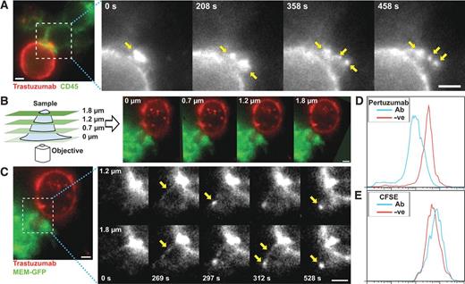 Figure 4. Fluorescence microscopy analyses using MUM reveal that trogocytosis involves tubular extensions of the cancer cells. A, individual frames from a live imaging experiment of MDA-MB-453: RAW264.7 cell conjugates. The cancer cells were opsonized by incubation with 10 μg/mL Alexa 555–labeled trastuzumab at room temperature for 10 minutes followed by washing. These cells were added to IFNγ-activated RAW264.7 macrophages expressing MEM-GFP (to label the plasma membrane; pseudocolored green) plated in dishes 30 minutes prior to imaging at a 1:1 effector:target cell ratio (2.5 × 104 cells). Grayscale images represent individual frames of the trastuzumab signal for the boxed region in the pseudocolored image showing trastuzumab (red) and MEM-GFP (green) signals. Yellow arrows indicate punctate structures accumulating inside the macrophage. B, schematic diagram of the MUM configuration and representative images from multiple focal planes of a macrophage:cancer cell conjugate formed between IFNγ-activated MEM-GFP–expressing RAW264.7 macrophages and MDA-MB-453 cancer cells opsonized with Alexa 555–labeled trastuzumab as above. C, individual frames showing the trastuzumab signal (black and white plots) of live cell imaging from two focal planes displaying a trogocytic event involving tubulation. Yellow arrows indicate intermediates in the tubulation process. Numbers in the lower part of each plot represent the acquisition time (seconds) for each image pair. The left plot shows an overlay of the MEM-GFP (pseudocolored green) and trastuzumab (pseudocolored red) at 1,020 seconds in the 1.8 μm focal plane. The boxed region is expanded in the grayscale images. D and E, flow cytometry analyses of pertuzumab and CFSE staining levels in MDA-MB-453 cells coincubated with RAW264.7 macrophages as described in Fig. 1B. Scale bars = 5 μm.