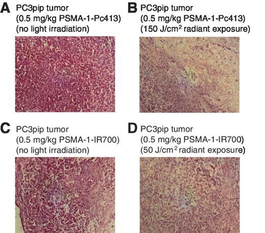 Figure 6. Histologic analysis of PC3pip tumors. Cell damage was observed in PDT-treated PC3pip tumors as compared with nontreated controls. A, control PC3pip tumor receiving PSMA-1-PC413. Mice received 0.5 mg/kg of PSMA-1-PC413 and tumors were taken out at 48 hours postinjection without light irradiation. B, PC3pip tumors receiving PSMA-1-Pc413 and treated with light. Mice received 0.5 mg/kg of PSMA-1-PC413, irradiated with light with radiant exposure at 150 J/cm2 light at 24 hours postinjection. Tumors were taken out at 24 hours after PDT treatment. C, control PC3pip tumor receiving PSMA-1-IR700. Mice received 0.5 mg/kg of PSMA-1-IR700 and tumors were taken out at 24 hours postinjection without light irradiation. D, PC3pip tumors receiving PSMA-1-IR700 and treated with light. Mice received 0.5 mg/kg of PSMA-1-IR700, and treated by light with radiant exposure at 50 J/cm2 light at 1 hour postinjection. Tumors were taken out at 24 hours after PDT treatment.