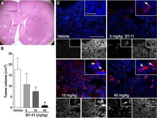 Figure 6. ST-11 activates caspase-3 and reduces glioblastoma multiforme tumor burden in a syngeneic mouse model of glioblastoma multiforme. A, representative image of a BALB/c mouse brain containing a DBT tumor 3 weeks after implantation and stained with H&E; scale bar, 500 μm. Additional H&E features are presented in Supplementary Fig. S1. B, daily intraperitoneal treatments of ST-11 for 2 weeks dose-dependently decreased tumor volume *, P < 0.05, one-way ANOVA with the Dunnett post hoc test. Results are mean ± SEM of at least 5 mice. C, representative images of activated caspase-3 (red) and DAPI (blue) staining in DBT tumor slices obtained from mice given the indicated treatments; scale bars, 25 and 10 μm (inset). Arrows, DBT cells with high levels of activated caspase-3 neighboring condensed nuclei.