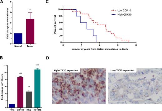 Figure 1. CDK10, overexpressed in colorectal cancer cell lines and tissues, is associated with significantly poorer outcomes in individuals with colorectal cancer. A, CDK10 transcript levels in paired normal human colon versus tumor tissues from individuals with colorectal cancer. Results represent the average of data from 16-paired samples (mean ± SEM). Statistical significance calculated by paired, two-tailed Student t test (*, P < 0.05; **, P < 0.01; ***, P < 0.001). B, Relative gene expression of CDK10 in normal colon FHC cell line, and colorectal cancer cell lines MIP101, RKO and HCT116 cells by qRT-PCR analysis. Fold changes were calculated relative to FHC cells. Results represent the average of > three independent experiments (mean ± SD). C, Kaplan–Meier survival curves of patients with colorectal cancer individuals with tumors expressing high CDK10 were at significantly higher risk of early disease relapse, hazard ratio 2.094, P = 0.0979 (log-rank test). D, Representative images of CDK10 expression in colorectal cancer scored as high expression and low expression; ×20, magnification.