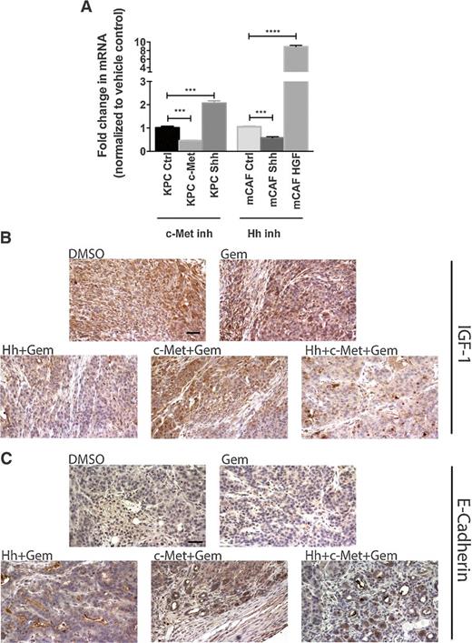 Figure 6. Compensatory overexpression/activation of alternative pathways explains single target resistance in PDAC. A, qRT-PCR analysis of c-Met, Shh, and GAPDH (control) in KPC tumor cells after c-Met inhibitor treatment and qRT-PCR analysis of Shh, HGF, and GAPDH (control) in mCAFs after Hh inhibitor treatment. The gene was normalized to GAPDH and is shown as a fold change. B and C, Representative IHC images of primary tumors from the orthotopic mouse model stained for expression of IGF-1 (B) and E-cadherin (C). Mice were treated for 1 week (as shown in Fig. 1A). The data are representative of one experiment. Mice that died before the completion of the planned treatment or whose quality of tumor was not adequate for analysis due to necrosis were excluded. Gem-gemcitabine (n = 8), Hh-Hh inhibitor + gemcitabine (n = 9), c-Met- HGF/c-Met inhibitor + gemcitabine (n = 7), DMSO-vehicle control (n = 9), Hh + c-Met + gemcitabine (n = 8). Scale bar, 200 μm.
