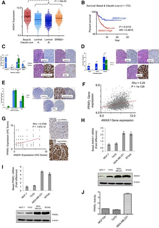 Figure 1. High level of expression of ANXA1 and PPARγ positively correlates with the invasive, high-grade phenotype. A, ANXA1 gene expression values in various breast cancer subtypes collected from public database Gene Omnibus (GEO). B, Correlation of ANXA1 expression to breast cancer survival. Kaplan–Meier plot shows ANXA1-high (red color) and ANXA1-low groups (blue color) defined by median of ANXA1 expression in basal and claudin-low breast cancer samples (n = 172). Log-rank test was used to compute the P value. HR, hazard ratio. C and D, Clinicopathogic examination of patient tissue samples with ANXA1 positive expression in IHC staining. Bar chart (left panels) indicate percentage of patient breast tumor tissues stained positively/negatively for ANXA1, categorized according to molecular classification of breast cancer subtypes. Corresponding anti-ANXA1 IHC staining (right) shows ANXA1 expression detected across different molecular subtypes of breast cancer (BC). E, Clinicopathogic examination of patient tissue samples with ANXA1 and Ki-67–positive expression in IHC staining. Bar chart indicates the percentage (%) of patient's breast tumor tissue stained for either positively/negatively of ANXA1 or Ki-67 and categorized according to the molecular classification of breast cancer subtypes. Corresponding anti-ANXA1 and anti-Ki-67 IHC staining was detected the expression of ANXA1/Ki-67 across in different molecular subtypes of breast cancer. F, Correlation between PPARγ and ANXA1 gene expression in breast cancer patients. The red dotted line is fitted with the linear regression curve. G, Correlation between PPARγ and ANXA1 expression in breast cancer tissues based on IHC scoring. The red dotted line is fitted with the linear regression curve. H, Relative basal ANXA1 levels of the same panel of cell lines. Data are the relative percentage (%) of changes ± SEM of three independent experiments (n = 3). Western blot analysis showed the basal ANXA1 expression levels in the same panel of cells. I, Relative basal PPARγ expression levels of the same panel of cells. Data are the relative percentage (%) of changes ± SEM of three independent experiments (n = 3). Western blot analysis showed the basal PPARγ protein levels in the same panel of cell lines. β-Actin was used as a protein loading control. J, Baseline PPARγ activity measured by using a PPRE luciferase read-out in normal breast cell line, MCF10A compared with that in a luminal type cell line, T47D, and a TNBC cell line, MDA-MB-231.