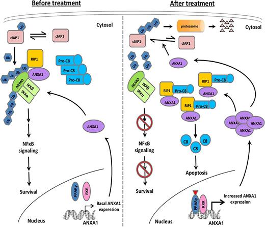 Figure 7. Schematic model summarizing the novel role of ANXA1 in mediating PPARγ-induced cell death in TNBC. Under basal conditions, NEMO binds to polyubiquitinated RIP1 and ANXA1 inducing constitutive activation of NFκB to promote cancer cell survival. Activation of PPARγ leads to increased expression of ANXA1 and RIP1 with decreased expression of NEMO. Increased interaction between ANXA1 as well as RIP1 (with decreased interaction of NEMO) dissociates E3 ligase, cIAP1 from RIP1 leading to its deubiqutination and recruitment of caspase-8 to mediate downstream cell death pathway.