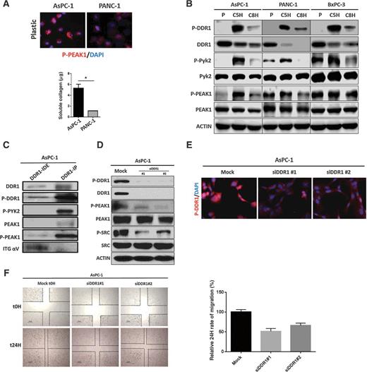 Figure 2. Effectors of DDR1 signaling in human PDA cell lines. A, Human PDA cell lines were plated in the absence of collagen I. The phosphorylation of PEAK1 was detected by immunocytochemistry. The secretion of soluble collagen (μg) was assessed in duplicate samples of human PDA cells by Sircol analysis. This depicted that AsPC-1 secreted an elevated level of collagen compared with PANC-1 cells. B, Human PDA cell lines AsPC-1, PANC-1, and BxPC-3 were plated on plastic (P) and stimulated with soluble collagen I (50 μg/mL) for 5 hours (C5H) or 8 hours (C8H). Lysates were probed for indicated targets by Western blot analysis. C, Immunoprecipitation (IP) analysis of DDR1 interactions. The DDR1 IP pulled down PYK2 and PEAK1, but did not pull down alpha V integrin (ITG αV) as shown in the immunodepleted (IDE) fraction. D, siRNA-mediated knockdown of DDR1 compared with mock siRNA control reduced the activation of DDR1, PEAK1, and SRC. Lysates were probed for the indicated targets by Western blot analysis. E, siRNA-mediated knockdown of DDR1 compared with mock siRNA control reduced the activation of DDR1 through immunocytochemistry. F, siRNA-mediated knockdown of DDR1 compared with mock siRNA control reduced the migration of human PDA cells (AsPC-1) after a 24-hour period of time via scratch migration assay. Error bars: *, P < 0.05, one-way ANOVA with Tukey MCT.