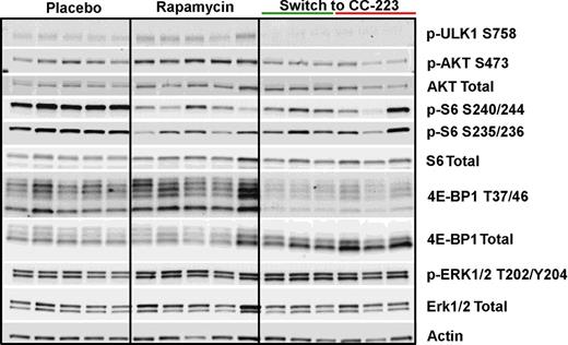 Figure 4. Compared with placebo- or rapamycin-treated tumors, CC-223–treated mice had a more complete inhibition of mTOR targets irrespective of tumor response. Western blot analyses of tumor lysates. Each lane was loaded with lysates from individual mouse tumors. The green and red bars indicate, respectively, tumors that either responded to treatment or did not respond based on mRECIST criteria. Total actin was used as a loading control.