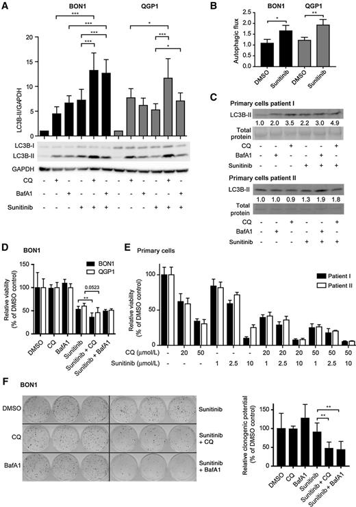 Figure 1. Sunitinib modulates autophagy in PanNET cell lines and primary cells and combination with autophagy inhibition reduces viability and recovery. A, Representative immunoblot for LC3B in BON1 and QGP1 cells upon 24-hour sunitinib (10 μmol/L), 24-hour CQ (20 μmol/L in BON1, 50 μmol/L in QGP1), 5.5-hour BafA1 (200 nmol/L). LC3B-II levels were normalized to GAPDH or total protein, n ≥ 4. B, Autophagic flux in BON1 and QGP1 cells calculated from percentage of proteolysis in long-lived protein degradation assay (treatment with BafA1–treatment without BafA1), n = 4. C, Immunoblots for LC3B in primary cells isolated from PanNET patients I and II upon 7-hour sunitinib (10 μmol/L), 7-hour CQ (20 μmol/L), 2-hour BafA1 (200 nmol/L). LC3B-II levels were normalized to total protein and are indicated below the corresponding LC3B-II immunoblot, n = 1. D, Viability of BON1 and QGP1 cells upon treatment. MTT assay was performed after 72-hour treatment with sunitinib (10 μmol/L), CQ (BON1 20 μmol/L, QGP1 50 μmol/L), BafA1 (20 nmol/L), and values were normalized to control, n ≥ 2. E, Viability of primary cells isolated from PanNET patients I and II upon treatment. ATPlite assay was performed after 48-hour treatments with indicated concentrations of CQ and sunitinib and values were normalized with control, n = 1, error bars show technical replicates. F, Representative picture and quantification of clonogenic assay in BON1 cells. The image shows triplicates for each treatment of one representative experiment. Colonies were fixed and stained after two weeks without treatment and colony numbers were normalized to control, n ≥ 3. Statistical analysis was performed using unpaired t test, *, P < 0.05; **, P < 0.01; ***, P < 0.001; ****, P < 0.0001.
