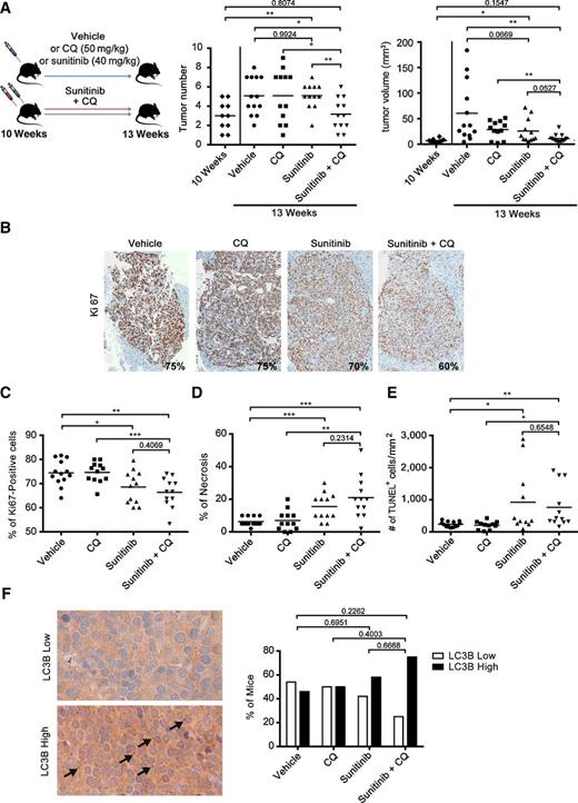 Figure 2. Significant antitumor effect in vivo upon combination treatment. A, Graphic representation of the mouse treatment and macroscopically assessed tumor volume and number in Rip1Tag2 mice at 10 weeks of age and after three weeks of daily treatment with vehicle, CQ, sunitinib, or sunitinib + CQ (10 weeks n = 10, vehicle n = 13, CQ n = 12, sunitinib n = 12, sunitinib + CQ n = 12), unpaired t test. B, IHC staining for the proliferation marker Ki67. Percentage of Ki67-positive cells was estimated in 3–14 tumors >1 mm per mouse as shown in representative pictures with corresponding percentage of positive cells. C, Quantification of Ki67 staining. The graph shows the mean percentage of positive cells per mouse (vehicle n = 13, CQ n = 12, sunitinib n = 12, sunitinib + CQ n = 12), unpaired t test. D, Quantification of percentage of necrosis determined on H&E staining (vehicle n = 13, CQ n = 12, sunitinib n = 12, sunitinib + CQ n = 12), unpaired t-test. E, Quantification of number of TUNEL-positive cells/mm2 as determined in one high-power field per mouse (vehicle n = 13, CQ n = 12, sunitinib n = 12, sunitinib + CQ n = 12). F, IHC staining for LC3B. Classification of each mouse in LC3B punctae high or low based on abundance of dot staining as shown in representative pictures (LC3B punctae low: no dots in most of the tumors, LC3B punctae high: dots in most of the tumors). The graph presents the percentage of mice with LC3B high/low punctate staining (vehicle n = 13, CQ n = 12, sunitinib n = 12, sunitinib + CQ n = 12), Fisher exact test. *, P < 0.05; **, P < 0.01; ***, P < 0.001; ****, P < 0.0001.
