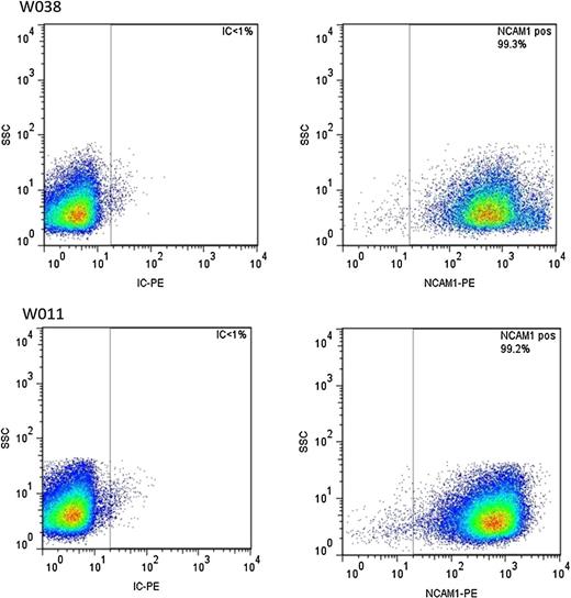 Figure 2. Evaluation of NCAM expression in patient-derived WT cells. Tumor-bearing mice were euthanized, and isolated tumor cells were evaluated using flow cytometry for their fraction of NCAM-expressing cells (IC = isotype control. Graphs are shown on the left panels of each patient-derived cell). Both patient-derived cells (W038, top; W011, bottom) expressed high levels of NCAM.