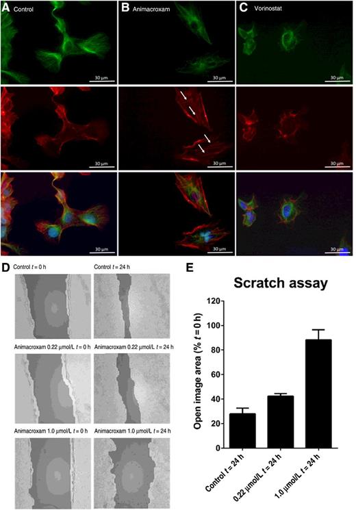Figure 7. Cytoskeletal alterations and antimigratory effects of animacroxam. In contrast to vorinostat, animacroxam induced the formation of f-actin stress fibers in cisplatin-sensitive TGCT cells, as indicated by arrows. A, Untreated control, B, Treatment (48 hours) with animacroxam (0.22 μmol/L). C, Treatment (48 hours) with vorinostat (1.5 μmol/L). Green, α-tubulin; red, f-actin; blue, DAPI. Magnification, ×40. D, Representative images of antimigratory effects of animacroxam analyzed by scratch assays. Incubation for 24 hours with animacroxam (0.22 and 1.0 μmol/L) resulted in a reduced migration of cisplatin-sensitive 2102EP cells as shown by a repressed closure of the open image area. E, Quantification of the open image area (in %) after 0 and 24 hours of incubation with animacroxam. Results are given as means ± SD of n = 3 independent experiments.
