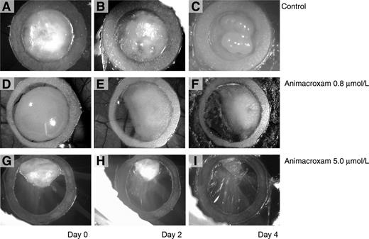 Figure 8. Antineoplastic effects of animacroxam in vivo. TGCT microtumors inoculated onto the CAM of fertilized chicken eggs showed a time- and dose-dependent reduction in tumor size and volume after animacroxam treatment. In contrast, NaCl (0.9%) treated control tumors time dependently increased in size and volume. A–C, NaCl-treated microtumor at the beginning of the treatment (A), after 2 days (B), and after 4 days (C). D–I, Animacroxam-treated microtumors (0.8 and 5 μmol/L) at the beginning of the treatment (D; G), after 2 days (E; H), and after 4 days (F; I). Representative findings of n = 3 independent preparations for each concentration.