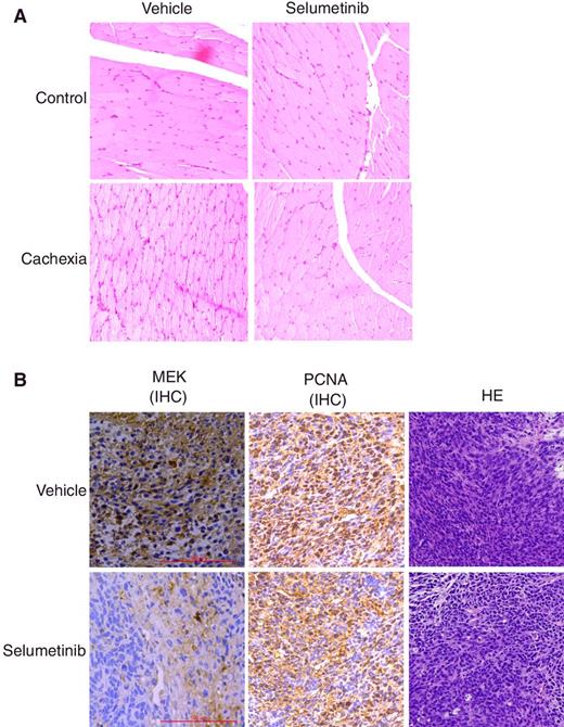 Figure 4. Effect of selumetinib on tumor MEK, PCNA expression, and the HE staining of tumor and gastrocnemius. The vehicle-treated mice show morphologic atrophy based on HE-staining results of gastrocnemius. However, selumetinib alleviated the muscle atrophy (A). The comparable PCNA expression between selumetinib and vehicle treatment indicated selumetinib had no influence on CT26 cell proliferation. However, selumetinib treatment decreased MEK expression when comparing with the expression of PCNA in the tumor based on IHC (B).