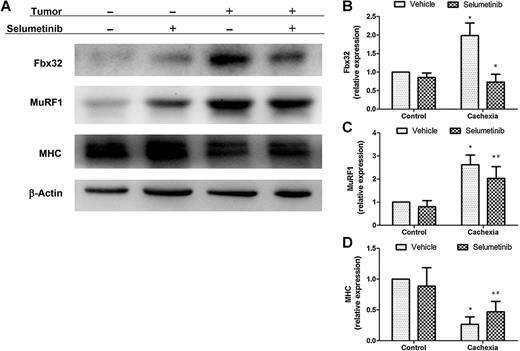 Figure 6. Effect of selumetinib on MHC, Fbx32, and MuRF1 of the gastrocnemius muscle. The representative Western blot analysis (A) and the relative band densities compared with vehicle-treated control group normalized with β-actin show that selumetinib decreased cancer-induced increase in E3 ligases Fbx32 (B) and MuRF1 (C) and increased MHC (D) expression of the gastrocnemius muscle. Data represent the means ± SD. *, P < 0.05 versus the value of vehicle-treated control group, and #, P < 0.05 versus the value of vehicle-treated cachexia group (Student t test).