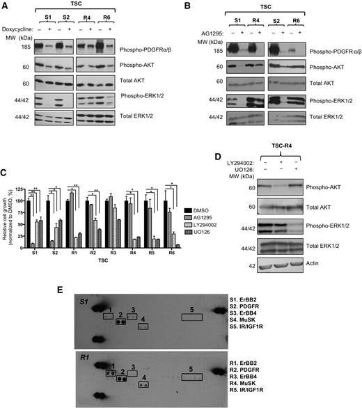 Figure 2. The proliferation of TSCs resistant to hPDGFB suppression is repressed by inhibition of the PI3K or MAPK pathway. A, Western blot analysis of phosphorylated PDGFR and phosphorylated and total AKT and ERK1/2 in TSCs grown in the presence (+) or absence (−) of doxycycline (1 μg/mL) for 48 hours. B, Western blot analysis of phosphorylated PDGFR and phosphorylated and total AKT and ERK1/2 in TSCs grown in the presence (+) or absence (−) of AG1295 (10 μmol/L) for 48 hours. C, Relative cell growth measured by ATP content of TSCs treated with DMSO, AG1295, LY294002, or UO126 at 10 μmol/L for 120 hours. DMSO was used as a control. Data represent three or more independent experiments conducted in triplicate presented as the mean +/− SEM. *, P < 0.05; **, P < 0.01. D, Western blot analysis of phosphorylated and total AKT and ERK1/2 in TSC-R4 grown in the presence (+) or absence (−) of LY294002 (10 μmol/L) or UO126 (10 μmol/L) for 48 hours. E, RTK Antibody Array (R&D Systems, Inc.). Following treatment of TSC-S1 and TSC-R1 with doxycycline (1 μg/mL) for 48 hours, whole-cell lysates were used to probe RTK antibody arrays, upon which a series of antibodies to RTKs were spotted in duplicate. Expressed RTKs are framed and numbered. The corresponding RTK is listed on the right.