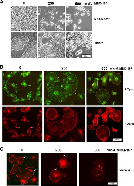 Figure 2. Breast cancer cell phenotype following MBQ-167 treatment. A, Top, Bright-field images of MDA-MB-231 human metastatic breast cancer cells in response to MBQ-167. Bottom, MCF7 cells in response to MBQ-167. B and C, Focal adhesions and actin cytoskeleton following MBQ-167 treatment showing representative fluorescent micrographs of MDA-MB-231 cells. MDA-MB-231 cells were treated with 0, 250, or 500 nmol/L MBQ-167 for 24 hours and fixed and stained in B, with phospho-tyrosine antibodies for focal adhesions (green) and rhodamine phalloidin for F-actin (red) and in C, with anti-vinculin (red). Arrows, invadopodia; arrowheads, focal adhesions.