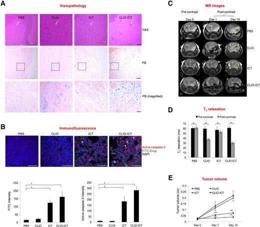 Figure 3. CLIO-ICTs are delivered to GBM tumors and induce tumor apoptosis. Tumors were initiated with orthotopic injections of pcGBM39 tumors and mice were treated with CLIO-ICT (0.5 mmol Fe/kg and 80 mg/kg of ICT), ICT (80 mg/kg of ICT), CLIO (0.5 mmol Fe/kg) or vehicle. A, Top, representative H&E staining for brain coronal sections from control and treated animals. White arrows indicate tumor. Objective 4×. Scale bar, 100 μm. Middle, Prussian blue iron staining for control and treated tumors. Objective 4×. Scale bar, 100 μm. Bottom, Prussian blue at higher magnification 10× for boxed regions in middle panel. Scale bar, 40 μm. B, Representative immunofluorescence confocal images for cleaved caspase-3 in control and treated pcGBM39 tumors. Arrows indicate cleaved caspase-3–positive cells. Nuclei counterstained with DAPI. Scale bar, 75 μm. Graph shows quantification for FITC and cleaved caspase-3 staining in control and treated pcGBM39 tumors. Results are represented as mean ± SD from three independent experiments. *, P < 0.05; **, P < 0.005, one-way ANOVA. C, Representative T2-weighted MR images of mice brain. T2 FSE sequences were used to capture coronal T2-weighted images. Nanoparticle and theranostic nanoparticle delivery is demonstrated by T2 darkening or negative enhancement in CLIO and CLIO-ICT–treated animals, respectively. On day 14, tumor periphery is marked by dotted yellow line. D, Quantification of T2 darkening. T2 MSME sequences were used to generate T2 maps, Osirix software was used to calculate T2 values. CLIO and CLIO-ICT–treated tumors demonstrated shorter T2 values corresponding to T2 darkening or negative enhancement. E, Quantification of tumor volumes before and after treatment. T2-weighted MR scans were used to calculate tumor volumes using Osirix software (*, P < 0.05; **, P < 0.005, n = 6, one-way ANOVA).