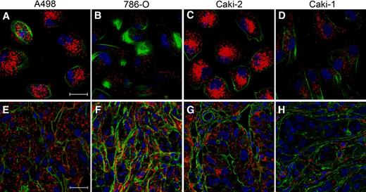 Figure 2. In vitro and in vivo cellular uptake of RGD-DPC. A–D, RGD-DPC internalization in cultured cells. Indicated renal cancer cell lines cultured on a cover glass were incubated with RGD-DPC formulated using Cy3-labeled polymer (red) in complete media at 2.5 μg/mL for 24 hours. Cell were fixed and counterstained with Alexa Fluor 488-phalloidin (20 nmol/L) for actin (green) and TO-PRO®-3 (40 nmol/L) for cell nuclei (blue). Cover glass mounted slides were analyzed using a LSM710 confocal microscope. Confocal micrographs depicting a single 0.5-μm optical section are shown (magnification, 630×). E–H, RGD-DCP internalization in tumors implanted in mouse kidneys. Indicated cell lines were implanted into kidney subcapsule. RGD-DPC containing 100 μg of Cy3-labeled polymer (red) was injected via the tail vein. Tumors were excised 4 hours after injection and frozen tissue sections were prepared as described previously (29). Tissue sections were counterstained and analyzed as described above. Scale bars for A–D and E–H are 20 μm.