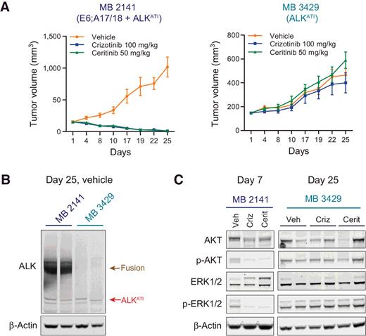 Figure 4. ALK inhibitors decrease growth of melanoma xenograft tumors expressing an EML4-ALK fusion, but not ALKATI only. A, MB 2141 and MB 1692 subcutaneous xenograft tumors were generated in nude mice and treated with vehicle, crizotinib (100 mg/kg), or ceritinib (50 mg/kg). Growth was measured biweekly for 25 days, at which time all tumors were harvested. B, Immunoblot analysis for total ALK and β-actin in tumor lysates from vehicle tumors harvested at day 25. Lysates from two independent tumors were analyzed for each condition. C, Immunoblot analysis for AKT/p-AKT, ERK1/2/p-ERK/1/2, and β-actin in MB 2141 tumors harvested after 7 days of treatment and MB 3429 tumors harvested after 25 days of treatment. Lysates from two independent tumors were analyzed for each condition for MB 3429 tumors. (Veh, vehicle; Criz, crizotinib; Cerit, ceritinib).
