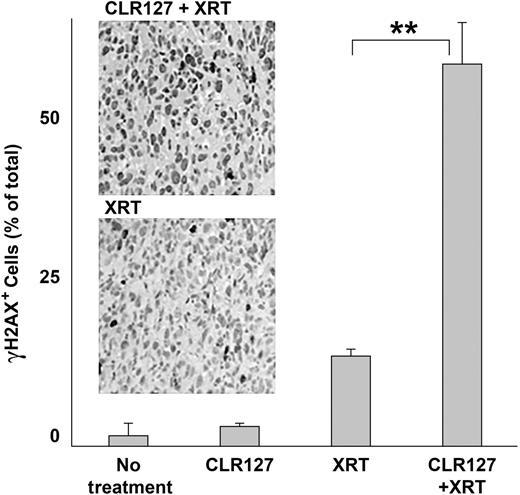 Figure 6. Effect of in vivo CLR127 and radiation on DNA damage repair. Mice bearing human prostate carcinoma PC-3 xenografts were treated with CLR127 (30 mg/kg/dose × 1 dose), XRT (8 Gy × 1 fraction) or the combination of CLR127 and XRT. CLR127 was injected intravenously 72 hours prior to radiation administration to allow for maximal uptake. Tumors were harvested 24 hours after radiation. γH2AX expression in the tumor xenograft was examined by IHC. Shown is the percentage of γH2AX-positive cells obtained from average of 12 visual fields randomly selected from three tumors per each treatment condition: excipient control/no treatment; CLR127 only; radiation only (XRT); and radiation and CLR127 treatment. Bars represent SE. Panels show examples of visual fields under microscopic examination (20× magnification). Top: CLR127 (CLR) and XRT, bottom: XRT only. **, P ≤ 0.001.