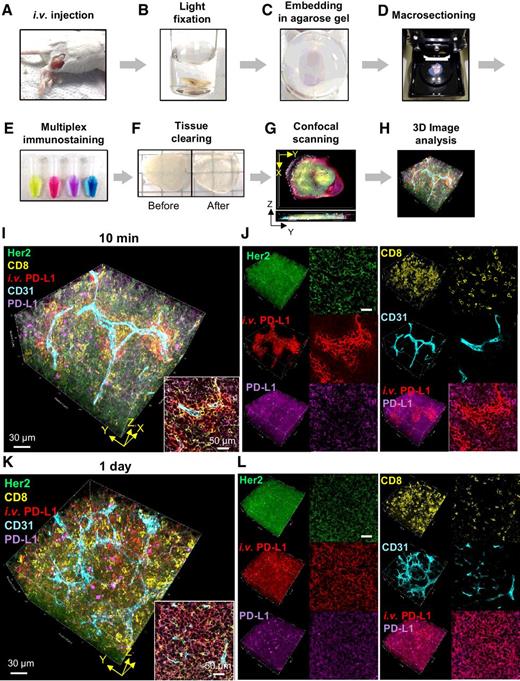 Figure 3. T3 for mapping drug distribution in tumor microenvironment. A–H, Workflow of T3. A, Fluorescent macromolecular drug was intravenously injected into tumor-bearing mice. B–D, The tumors were excised, fixed with 2% PFA solution for 10 minutes (B), embedded in 2% agarose gel (C), and sectioned at 400-μm thickness using a vibratome (D). E, The macrosections were stained with fluorescent primary antibodies. F, After washing and fixing, the macrosections were optically cleared by incubating with d-fructose solutions. G, Complete immunostaining for each macrosection was determined by optical cross-section (Z) scanning using a confocal microscope, and then each macrosection was imaged by XYZ scanning with multi-excitation and emission filters. H, 3D macrosection images were reconstructed, and macromolecular drug distribution in the tumor microenvironment was quantitatively analyzed using Fiji software. I–L, Spatial mapping of anti–PD-L1 antibody distribution kinetics in the tumor microenvironment. High-resolution 3D images show distribution patterns of anti–PD-L1 antibody (red) in TUBO tumors at 10 minutes (I and J) and 1 day postinjection (K and L). The tumors were lightly fixed, sectioned, and immunostained for Her2+ cancer cells (green), CD8+ T lymphocytes (yellow), CD31+ blood vessels (cyan), and PD-L1+ cells (magenta). I and K, 3D rendering of anti–PD-L1 distribution in the tumor microenvironment. Scale bar, 30 μm. Right bottom inserts, 2D optical section images. Scale bar, 50 μm. J and L, 3D (left) and 2D (right) channel images for each cellular marker and antibody drug.
