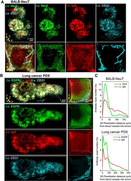 Figure 6. T3 analysis of tumor penetration of anti-Her2 or anti-EGFR and isotype IgG antibodies. Tumors collected 1 hour after intravenous coinjection of fluorescently labeled specific and isotype control antibodies and 10 minutes after intravenous injection of fluorescent anti-CD31 antibody. A, 3D rendering of macrosection of BALB-NeuT tumor indicating distribution of anti-Her2 (green), IgG isotype (red), and blood vessels (cyan). Low magnification 3D image (top, scale bar, 1 mm) demonstrates antibodies spreading through stroma with less delivery to tumor nests. High magnification 3D image (bottom, scale bar, 30 μm) of a single tumor nest suggests anti-Her2 antibody remains proximal to vasculature, while isotype control displays complete penetration. B, 3D rendering of macrosection of lung cancer PDX tumor indicating distribution of anti-EGFR (green), IgG isotype (red), and blood vessels (cyan). High magnification view (right) similarly displays limited penetration of anti-EGFR antibody compared with isotype control. C, 3D tumor penetration distance profiles of anti-Her2 and IgG antibodies in BALB-NeuT tumor (top) and anti-EGFR and IgG antibodies in lung cancer PDX tumor (bottom) determined as radial distance from CD31+ blood vessels at 1 hour after injection. Merged distance data are derived from total antibody voxels detected in the 3D images of tumor nests represented in A (bottom) and B (right).