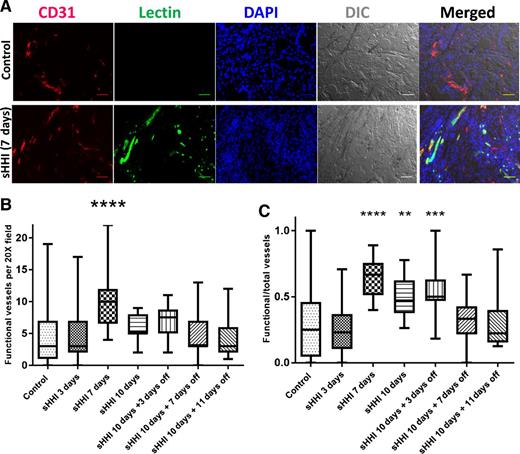 Figure 2. Effect of sHHI on tumor vascular status. Mice bearing tumor #18269 were treated daily p.o. for 10 days with NVP-LDE225 (40 mg/kg/day) and sacrificed at intervals. Ten minutes before sacrifice, groups of 3 mice were injected i.v. with 100 μg Lycopersicon esculentum (Le) lectin conjugated with FITC. A, Representative immunofluorescence and DIC images showing effect of sHHI on functional microvessels; CD31 staining (red) identifies total microvessels. Nuclei are counterstained with DAPI (blue). Costaining of CD31 and Le lectin (green) indicates blood-perfused (functional) vessels. Control, no treatment; scale bar, 50 μm. B, Change in number of functional vessels during the sHHI treatment; n = 3 mice for each time point in the sHHI treatment group and n = 9 mice in the control group. Five random fields (20X objective) were selected per tumor sample in each group. C, Change in the fraction of functional vessels during sHHI treatment. Center bar is median; box represents range of median 50%; vertical bars show minimum and maximum values. Statistical analysis was by one-way ANOVA with post hoc testing using Dunnett multiple comparisons test: **, P ≤ 0.01; ***, P ≤ 0.001; and ****, P ≤ 0.0001.