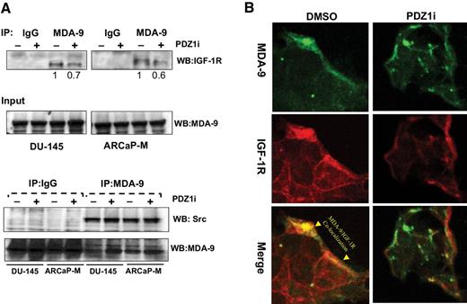 Figure 2. Effect of PDZ1i on MDA-9/Syntenin/IGF-R1 interactions. A, Cell lysates prepared from DU-145 and ARCaP-M cells, treated or untreated with PDZ1i, were subjected to IP using anti–MDA-9/Syntenin antibody and IB was performed using anti–IGF-1R antibody. Values from densitometry analysis are presented using MDA-9/Syntenin expression in the input as control. B, Representative photomicrographs of confocal images from PDZ1i pre-treated ARCaP-M cells. MDA-9/Syntenin and IGF-1R were labeled with green and red florescent probes, respectively. “Yellow dots” represent co-localized proteins.