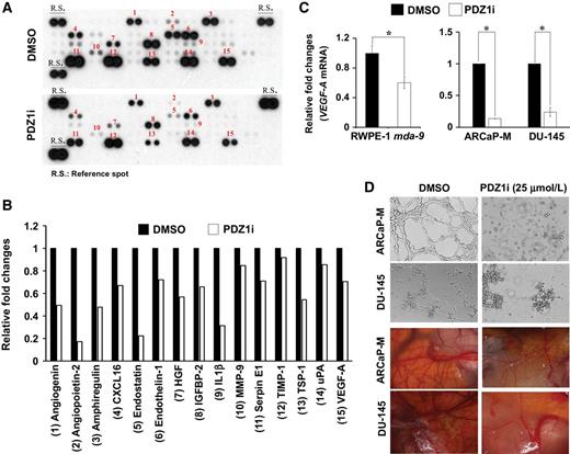Figure 4. PDZ1i suppresses production of tumor-derived pro-angiogenic factors. A, Blots from antibody arrays showing differential expression levels of various angiogenic factors following treatment with conditioned media derived from vehicle- or PDZ1i-treated ARCaP-M cells. B, Graphical representation of the band intensity in A quantified by densitometry. C, Cells were treated with DMSO or PDZ1i for 24 hours and expression of VEGF-A mRNA was analyzed. D, Pro-angiogenic activity of DMSO- or PDZ1i-treated tumor cell-derived conditioned media was analyzed in both in vitro (tube formation assay) and in vivo (CAM assay) contexts as described in Methods and Materials. Representative photomicrographs are presented.